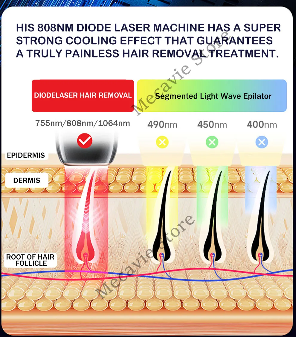 Alexandrite 4 Wavelength 808 Diode Hair Removal Laser Machine Ice Titanium Body Painless Physical Body Depilation Maker 4000W
Alexandrite 4 Wavelength 808 Diode Hair Removal Laser Machine Ice Titanium Body Painless Physical Body Depilation Maker 4000W