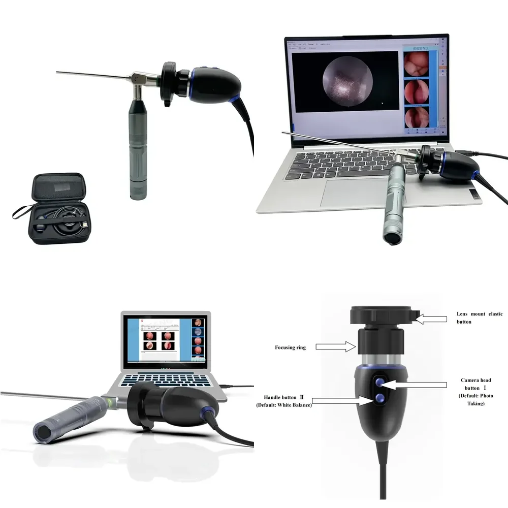 Factory Price ENT Veterinary USB HD USB ENT System
Factory Price ENT Veterinary USB HD USB ENT System