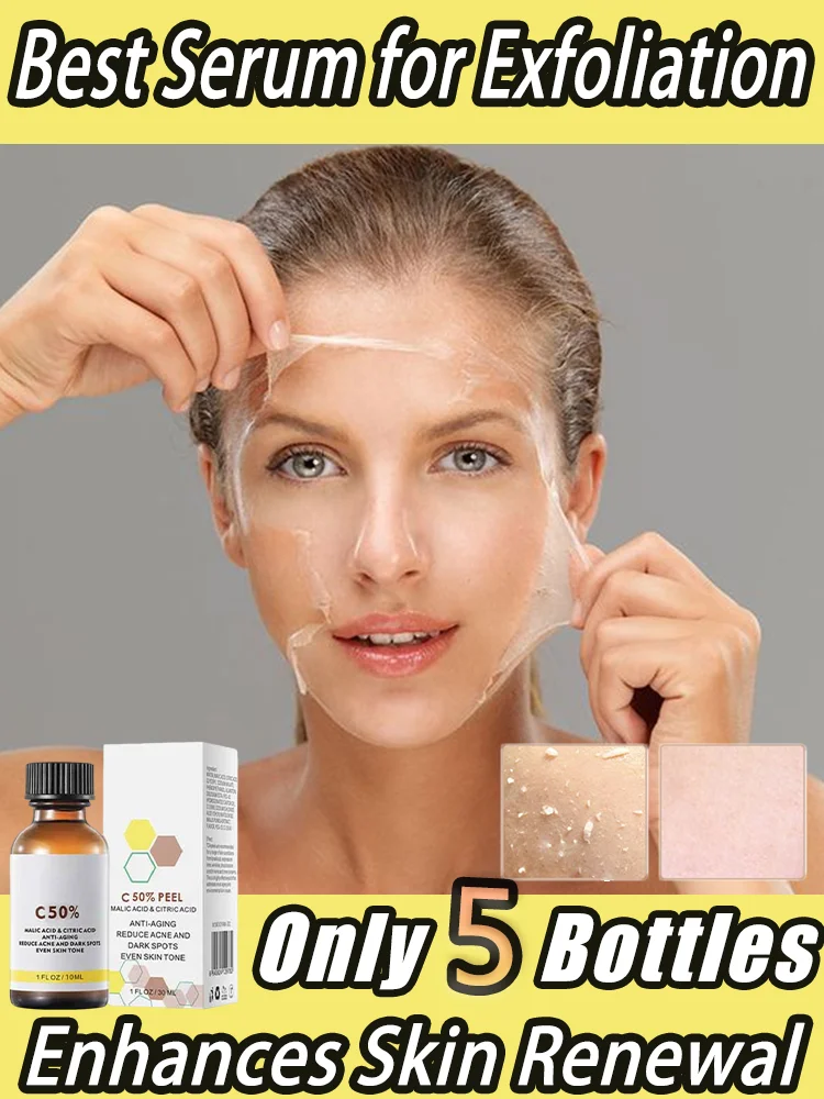 Высокое качество 50% химический отшелушивающий пилинг Tca Peel Acid Skin Superforce Пигментация Осветление меланина Акне Уход за красотой
Высокое качество 50% химический отшелушивающий пилинг Tca Peel Acid Skin Superforce Пигментация Осветление меланина Акне Уход за красотой