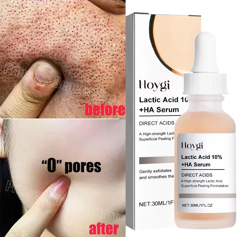 Remove Large Pores Serum Lactic Acid Facial Pore Shrinking Repairing Products Pore Minimizing Firming Smooth Korean Skin Care
Remove Large Pores Serum Lactic Acid Facial Pore Shrinking Repairing Products Pore Minimizing Firming Smooth Korean Skin Care