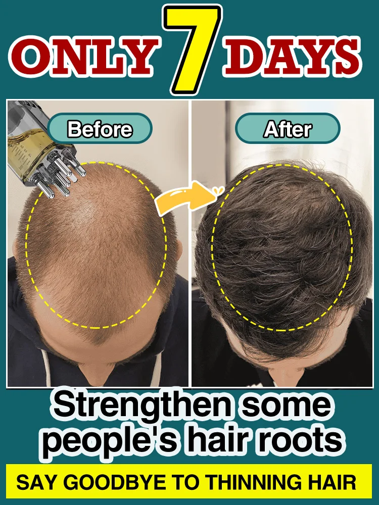 АПЛОКАДОР, MASAJE, ABORPCIN PROMOCIONAL, PARA CABELLO, VENTA CALIENTE, OFERTA PROMOCOCIONAL, HERRAMIENTA DE CUENTAS DE MASAJE, AD
АПЛОКАДОР, MASAJE, ABORPCIN PROMOCIONAL, PARA CABELLO, VENTA CALIENTE, OFERTA PROMOCOCIONAL, HERRAMIENTA DE CUENTAS DE MASAJE, AD