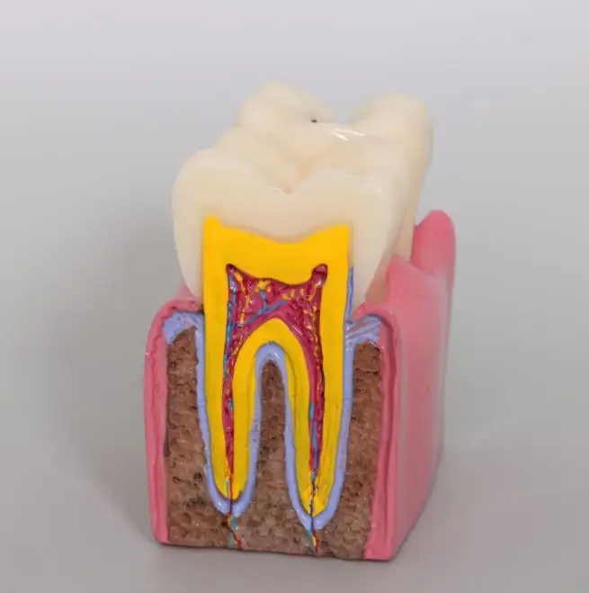 3 шт., стоматологические материалы, лабораторная модель зубов, 6 разных исследований кариеса, учебные модели для обучения и исследованию стоматологом
3 шт., стоматологические материалы, лабораторная модель зубов, 6 разных исследований кариеса, учебные модели для обучения и исследованию стоматологом