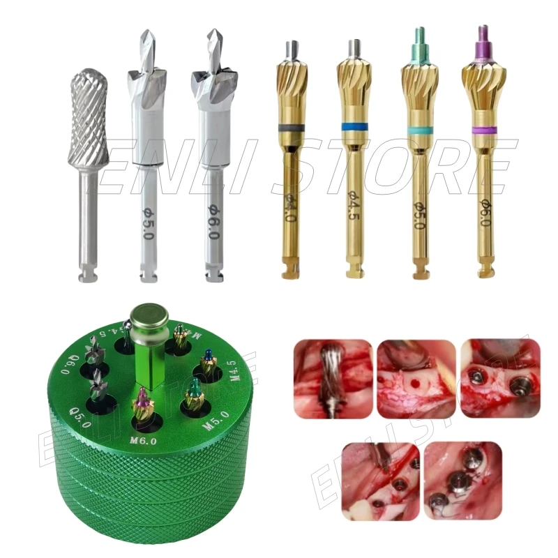 Dental Universal Implant Bone Profiler Grinding Bur With Pilot Drill Peri-Implant Debridement Drilling Surgical Instrument
Dental Universal Implant Bone Profiler Grinding Bur With Pilot Drill Peri-Implant Debridement Drilling Surgical Instrument