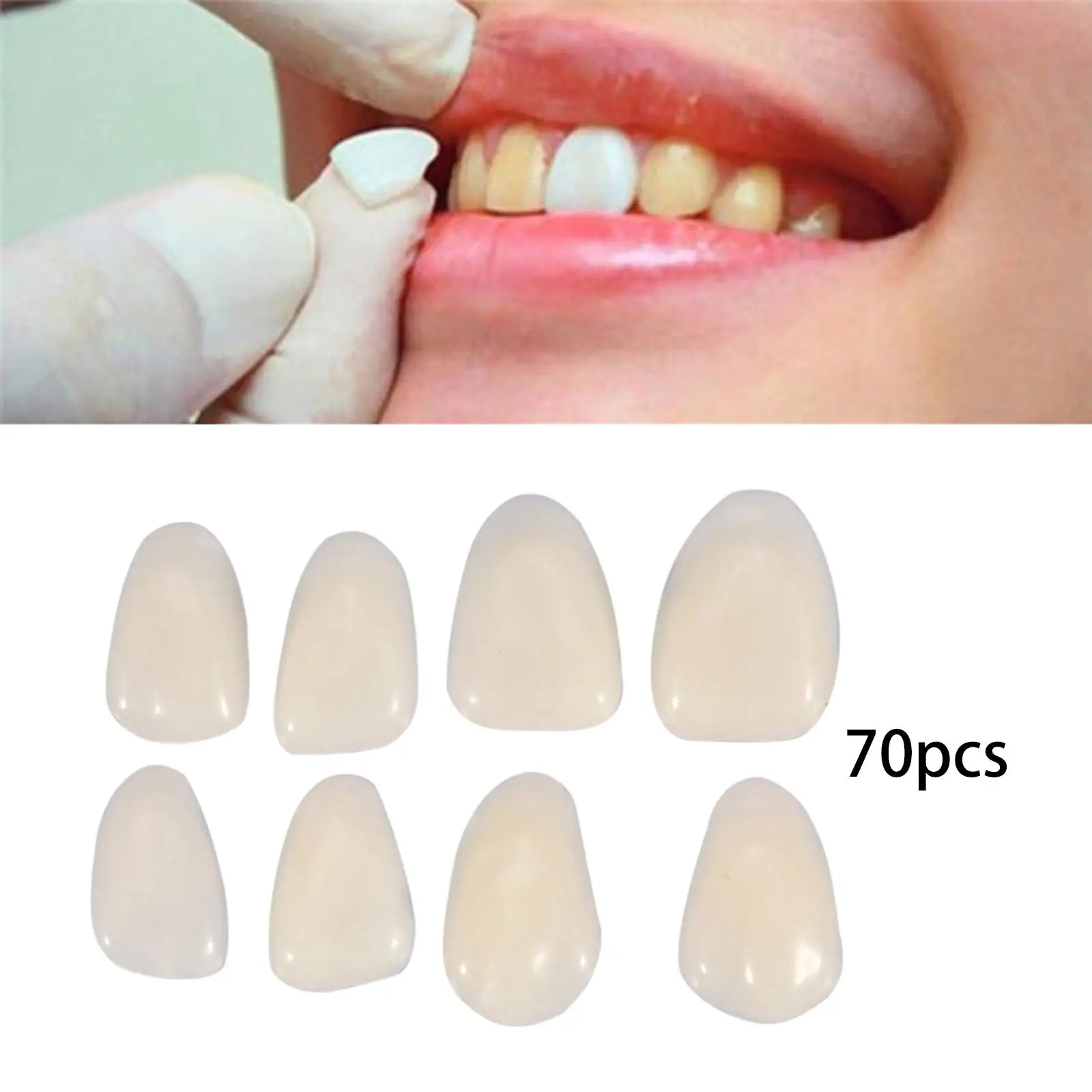 Виниры для красоты Временное отбеливание коронки зубов Виниры для временного ремонта зубов
Виниры для красоты Временное отбеливание коронки зубов Виниры для временного ремонта зубов