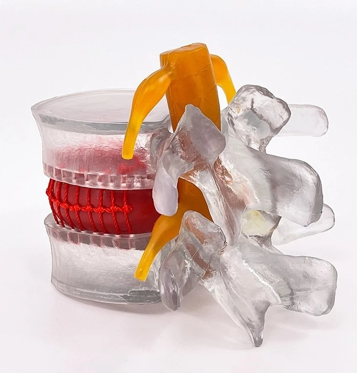 Lumbar spine model human lumbar disc demonstration teaching aid
Lumbar spine model human lumbar disc demonstration teaching aid