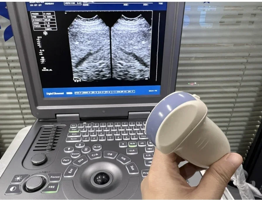 Vet Ultrasound Portable veterinary machine cheap price ecografo laptop full digital veterinary
Vet Ultrasound Portable veterinary machine cheap price ecografo laptop full digital veterinary