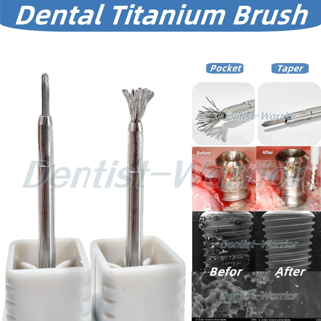 Dental Titanium Brush Surface Cleaning Brush Peri-implantitis Implant Debridement Bristles Dentist Tool Taper/Pocket
Dental Titanium Brush Surface Cleaning Brush Peri-implantitis Implant Debridement Bristles Dentist Tool Taper/Pocket