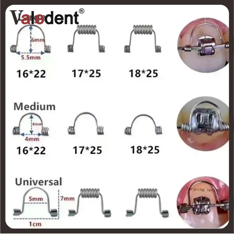 50 шт./упак. Стоматологические ортодонтические пружины для коррекции положения передних зубов, прямоугольные, универсальные (размеры L, M, S), из нержавеющей стали
50 шт./упак. Стоматологические ортодонтические пружины для коррекции положения передних зубов, прямоугольные, универсальные (размеры L, M, S), из нержавеющей стали