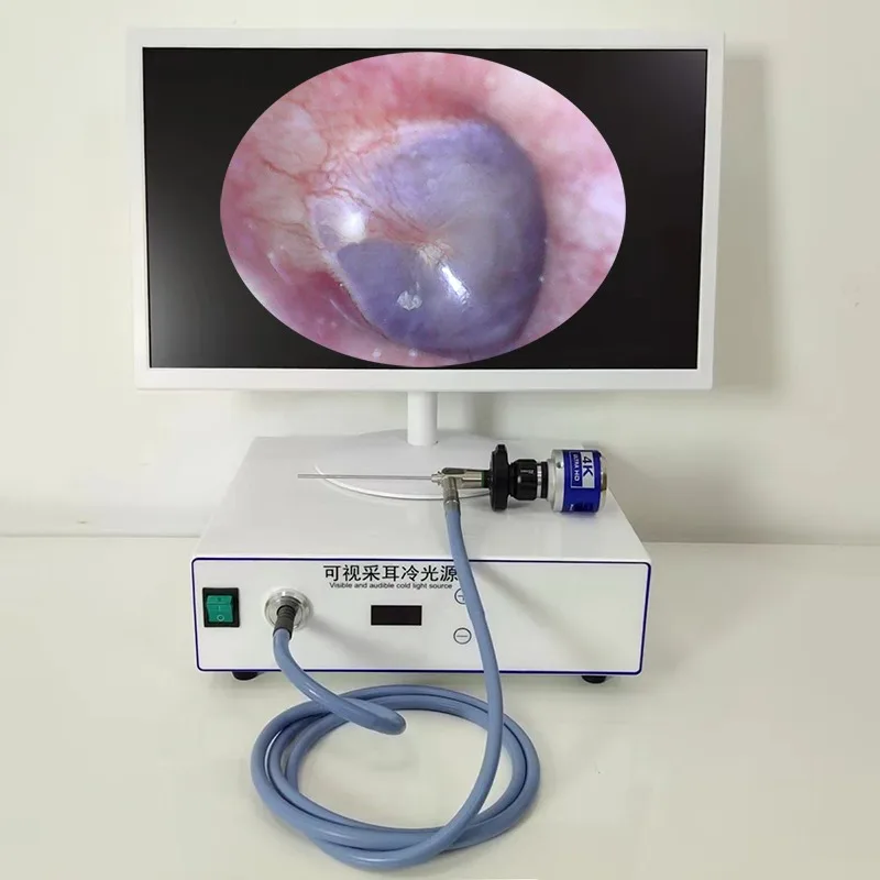 Оборудование для визуального сбора ушей Настольный хост высокой четкости ЛОР-источник холодного света
Оборудование для визуального сбора ушей Настольный хост высокой четкости ЛОР-источник холодного света