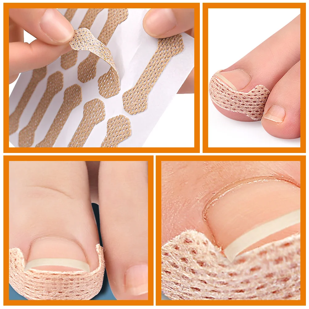 Toenail Corrector Strips Ingrown Toenail Correction Patch Nail Correction Tool Foot Care Treatment Patches Lightweight
Toenail Corrector Strips Ingrown Toenail Correction Patch Nail Correction Tool Foot Care Treatment Patches Lightweight