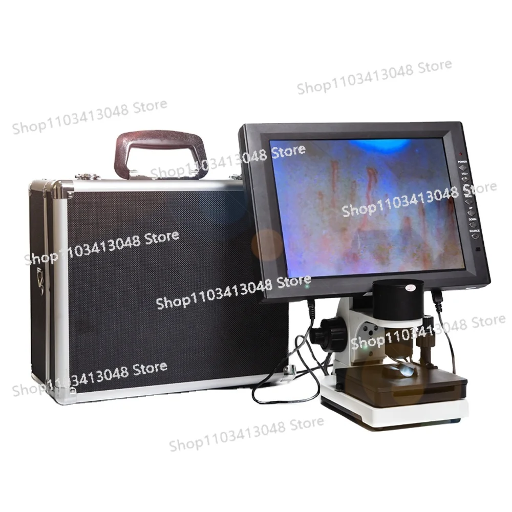 For sale household microcirculation capillary mirror machine
For sale household microcirculation capillary mirror machine