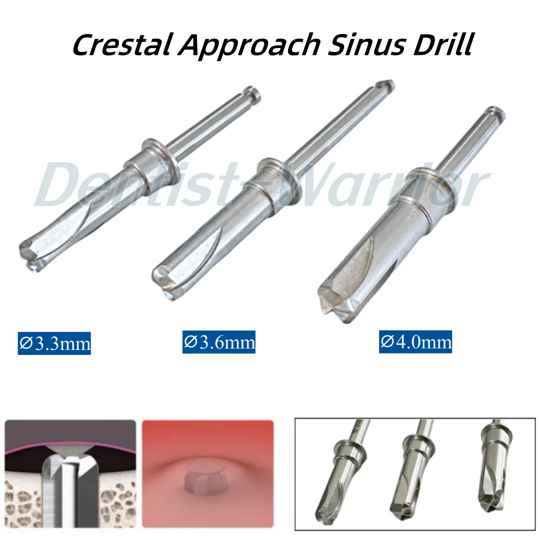 Dental Membrane Lifter Drills Compatible with Oss Crestal Approach Sinus CAS Drill 3.3/3.6/4.0mm
Dental Membrane Lifter Drills Compatible with Oss Crestal Approach Sinus CAS Drill 3.3/3.6/4.0mm