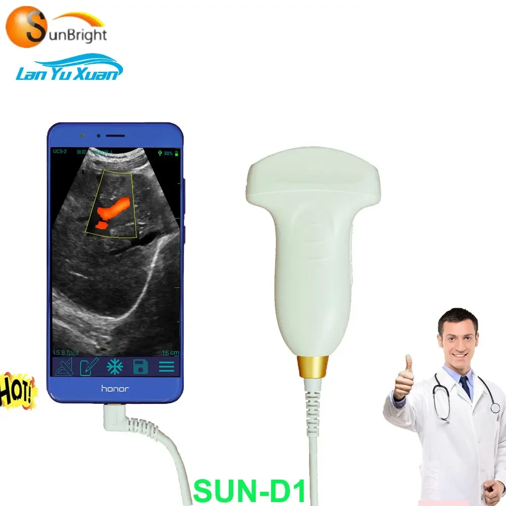 USG wifi production USB ultrasound probe wireless with color doppler image mode
USG wifi production USB ultrasound probe wireless with color doppler image mode
