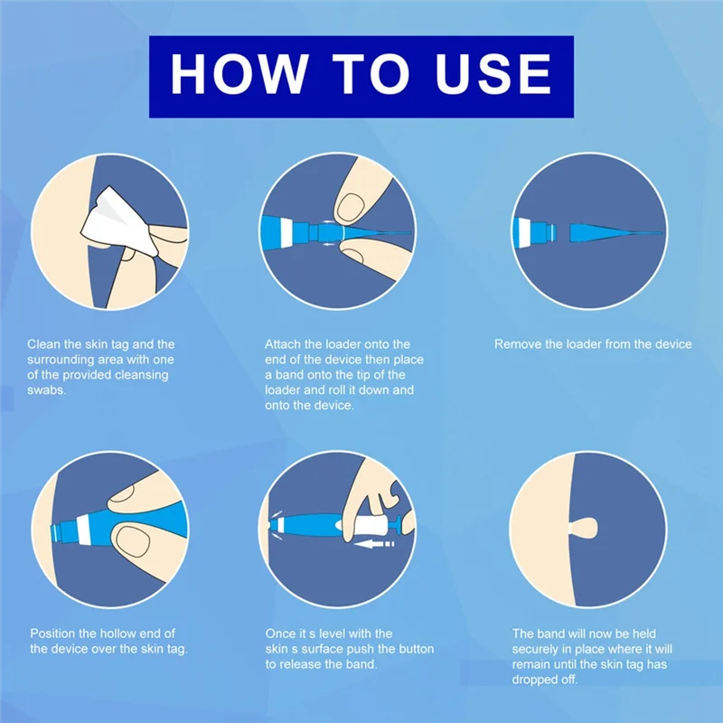 Auto Skin Tag Removal Kit Painless Mole Wart Skin Treatment Pen Band Dot Corn Treatments Body Facial Skin Removal Pen Tool
Auto Skin Tag Removal Kit Painless Mole Wart Skin Treatment Pen Band Dot Corn Treatments Body Facial Skin Removal Pen Tool