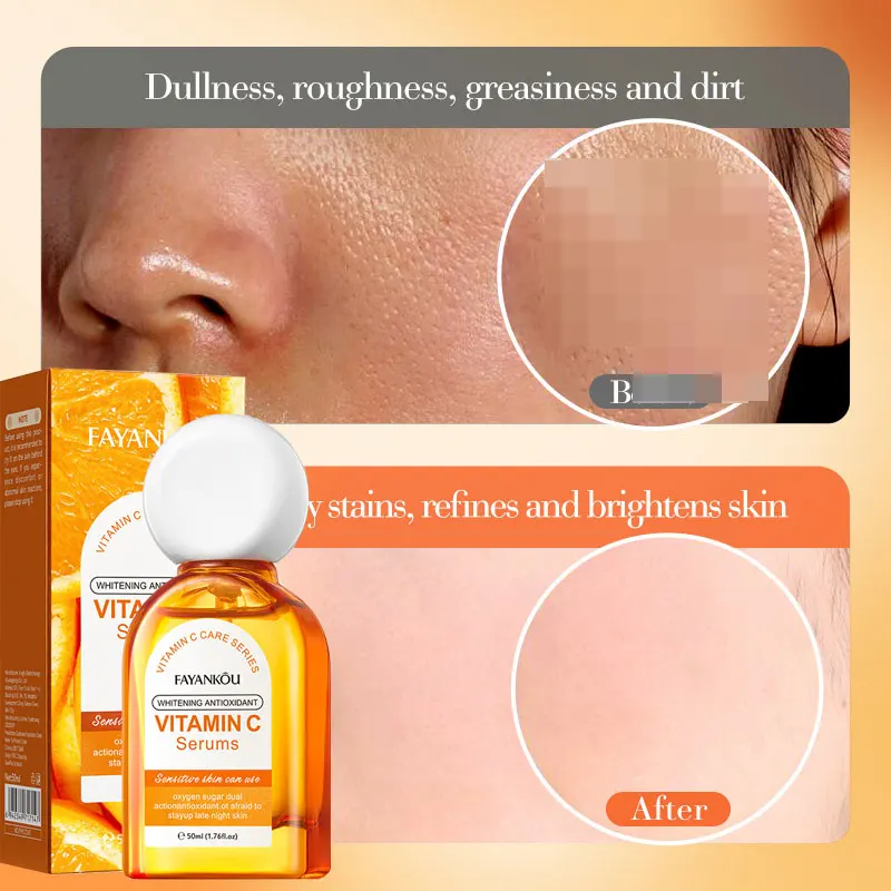FAYANKOU Vitamin C Whitening Antioxidant Essence Hydrating and Moisturizing Essence
FAYANKOU Vitamin C Whitening Antioxidant Essence Hydrating and Moisturizing Essence