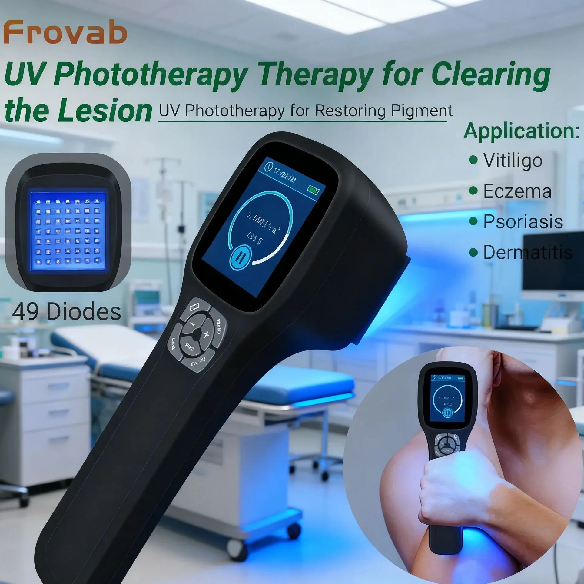 Профессиональная лампа для фототерапии UVB 308 нм, портативная светотерапевтическая машина для домашнего использования, терапия для лечения заболеваний кожи витилиго, 49 диодов
Профессиональная лампа для фототерапии UVB 308 нм, портативная светотерапевтическая машина для домашнего использования, терапия для лечения заболеваний кожи витилиго, 49 диодов