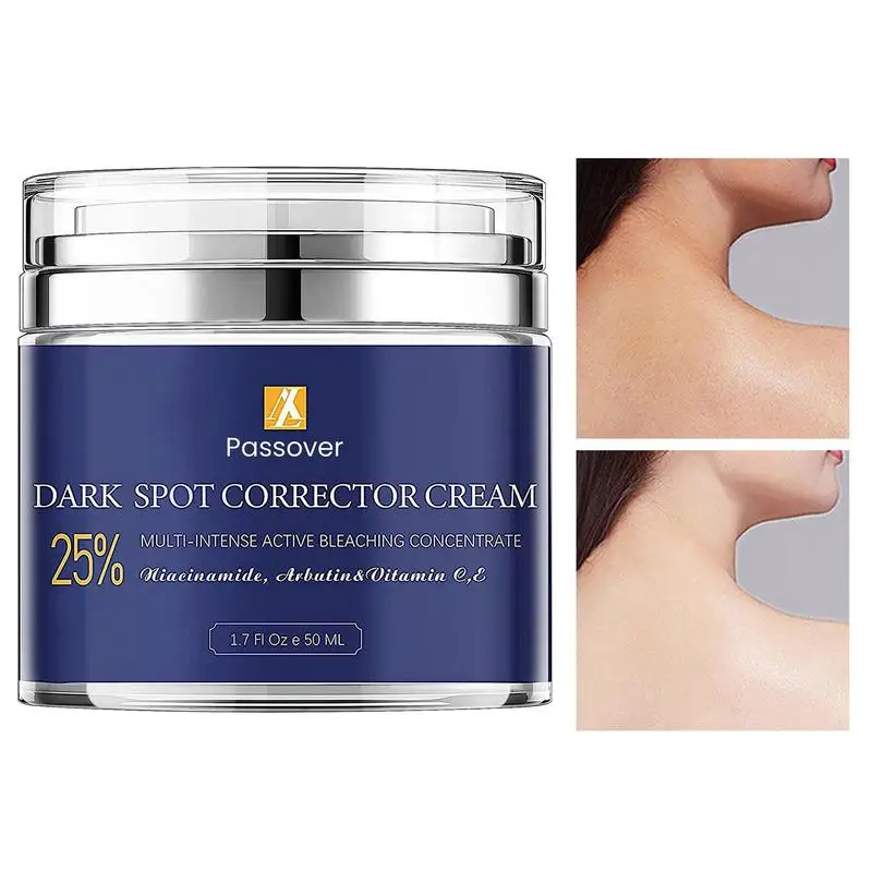 Body Whitening Cream Underarm Legs Knee Elbow Armpit Bleaching Cream Improve Dull Remove Dark Spots Melanin Brighten Skin Care
Body Whitening Cream Underarm Legs Knee Elbow Armpit Bleaching Cream Improve Dull Remove Dark Spots Melanin Brighten Skin Care