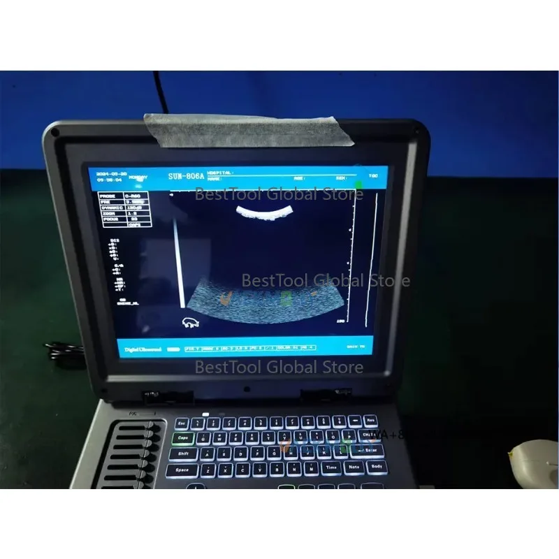Equipment Accurate De-tection for An-imal Reproductive and Health Conditions Cheapest Vete-rinary B - Mode Ultra-sound
Equipment Accurate De-tection for An-imal Reproductive and Health Conditions Cheapest Vete-rinary B - Mode Ultra-sound