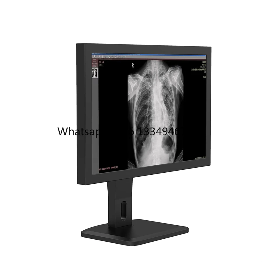 Best price High Accuracy Diagnostic Medical Lcd Display, Latest HD Medical Display, LCD Display discount
Best price High Accuracy Diagnostic Medical Lcd Display, Latest HD Medical Display, LCD Display discount