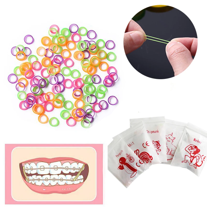 100pcs dental colored elastic latex rings, braces, dental rubber bands, non-toxic material 3.5OZ dental colored rubber bands
100pcs dental colored elastic latex rings, braces, dental rubber bands, non-toxic material 3.5OZ dental colored rubber bands