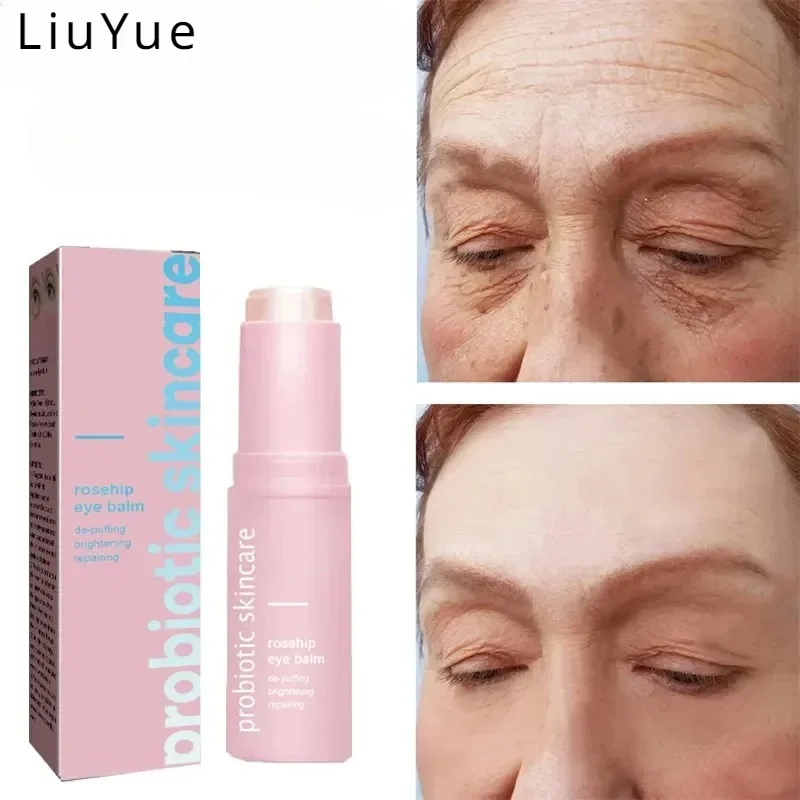 Women's Collagen Enhancing Eye Cream Brightens Skin Tone Lightens Facial Lines Facial Rejuvenation Essence Eye Cream Skin Care
Women's Collagen Enhancing Eye Cream Brightens Skin Tone Lightens Facial Lines Facial Rejuvenation Essence Eye Cream Skin Care