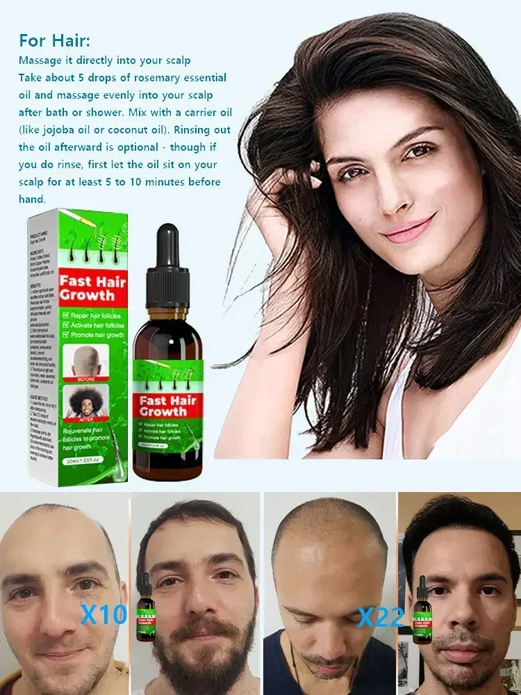Fast Hair Growth Promoter Products Hair Loss Hereditary Seborrheic Alopecia Treatment Oil For Hair Growth Essence Natural Safety
Fast Hair Growth Promoter Products Hair Loss Hereditary Seborrheic Alopecia Treatment Oil For Hair Growth Essence Natural Safety