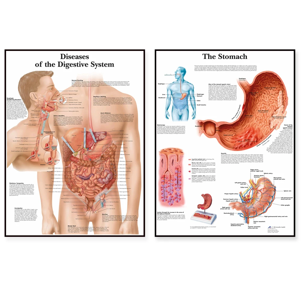 Digestive System diagram Art Poster Print Body Map Canvas Painting Wall Pictures for Medical Education Home Decor
Digestive System diagram Art Poster Print Body Map Canvas Painting Wall Pictures for Medical Education Home Decor