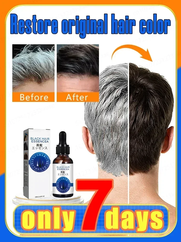 White Hair Killer, permanently removes white hair, restores natural hair color in 7 days
White Hair Killer, permanently removes white hair, restores natural hair color in 7 days