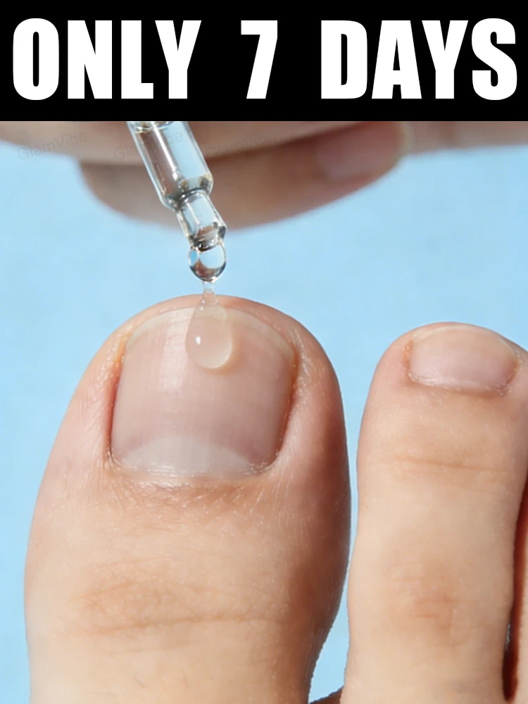 Great news! Free shipping in 2026! Nail care solution, 10ml
Great news! Free shipping in 2026! Nail care solution, 10ml