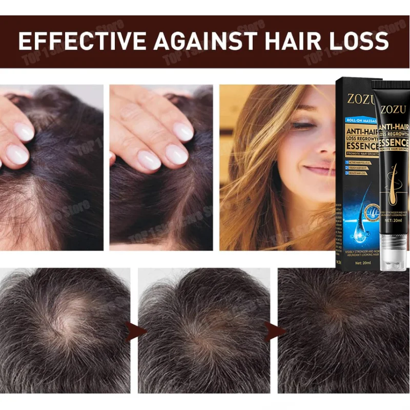 100% revive hair, strong penetration, activate hair roots, more hair, say goodbye to baldness, thick hair
100% revive hair, strong penetration, activate hair roots, more hair, say goodbye to baldness, thick hair
