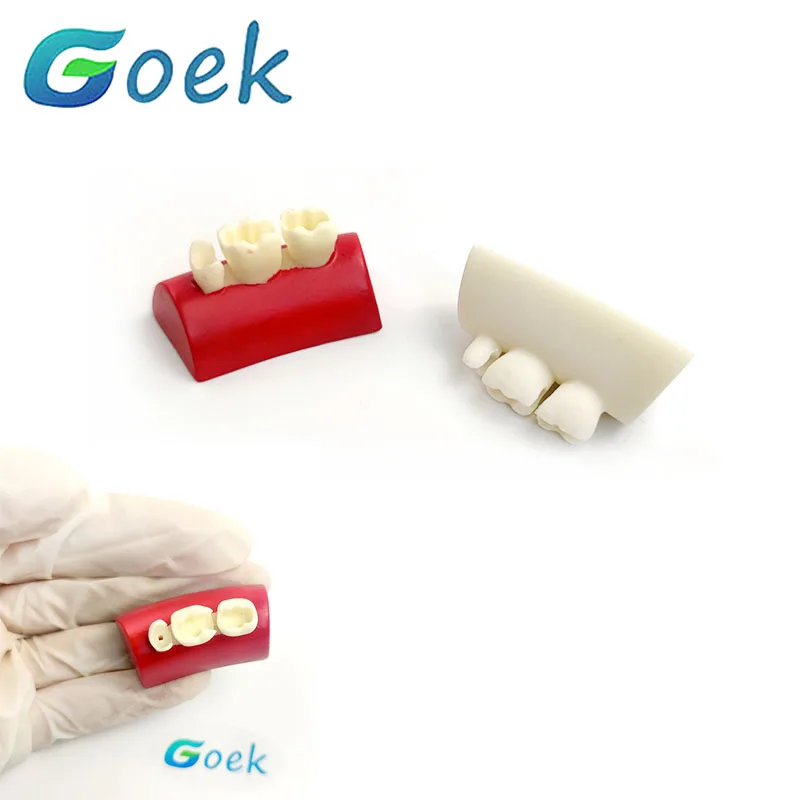 Dental Resin Block Filling Exercise Inlay Exercise Model Red White Dentistry Materials Tool
Dental Resin Block Filling Exercise Inlay Exercise Model Red White Dentistry Materials Tool