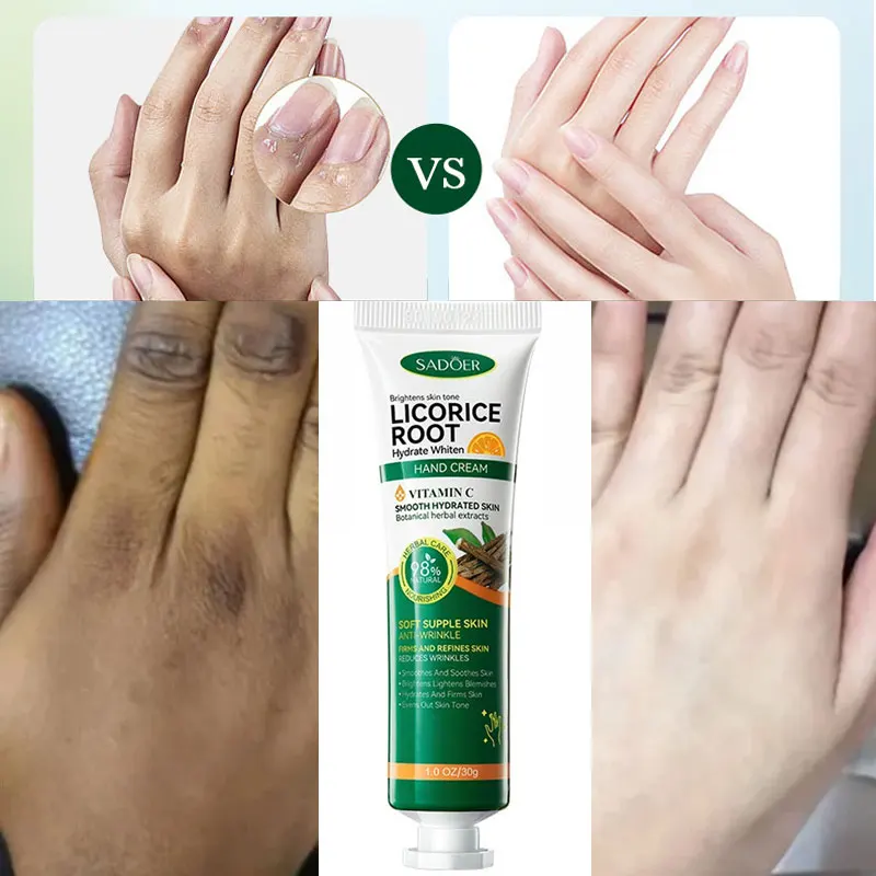 Fast Whitening Dark Knuckles Hand Cream Brighten Moisturizing Intense Stains Remover Melanin Corrector Products Hand Skin Care
Fast Whitening Dark Knuckles Hand Cream Brighten Moisturizing Intense Stains Remover Melanin Corrector Products Hand Skin Care