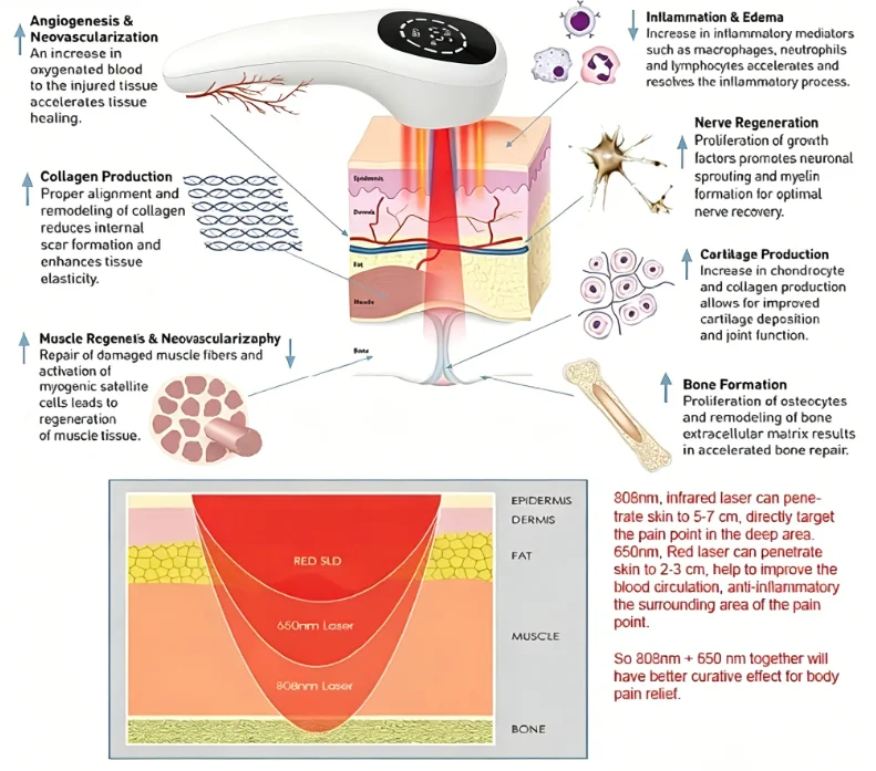 Cold Laser LLLT Therapy Device with Class 3b Laser, 880mW 650nm×16+808nm×4 Infrared Red Light, for Wound Healing & Pain Relief
Cold Laser LLLT Therapy Device with Class 3b Laser, 880mW 650nm×16+808nm×4 Infrared Red Light, for Wound Healing & Pain Relief