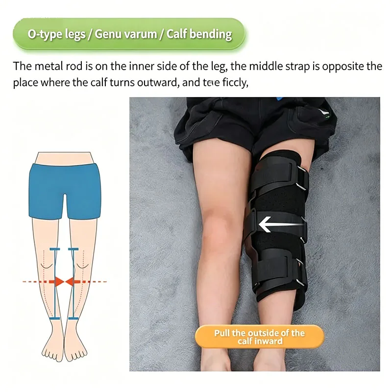 1Pcs O/X Leg Type Correction Belt Pediatric Kids Leg Posture Corrector Brace for Children Knees Valgus Straighten
1Pcs O/X Leg Type Correction Belt Pediatric Kids Leg Posture Corrector Brace for Children Knees Valgus Straighten