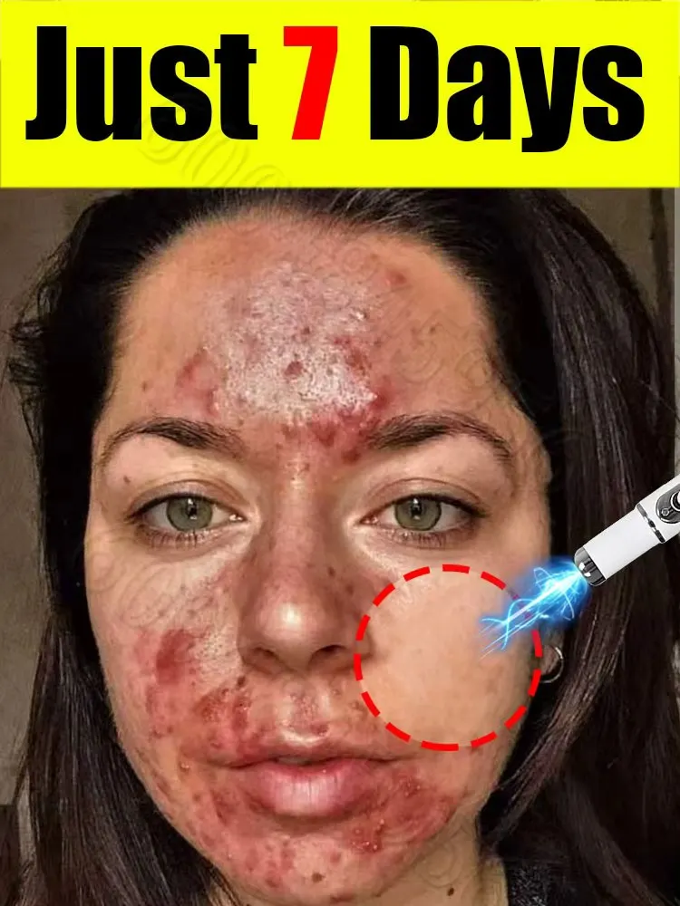 Bestselling products in 2026: Facial massager, facial cleansing brush, and freckle removal tools.
Bestselling products in 2026: Facial massager, facial cleansing brush, and freckle removal tools.