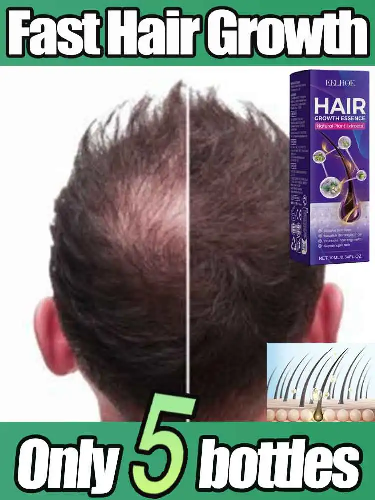 Hair Growth Essential Loss Regrowth Treatment Strengthens Hair Nourishes Scalp Light Weight Non Greasy Improve Scalp Circulation
Hair Growth Essential Loss Regrowth Treatment Strengthens Hair Nourishes Scalp Light Weight Non Greasy Improve Scalp Circulation