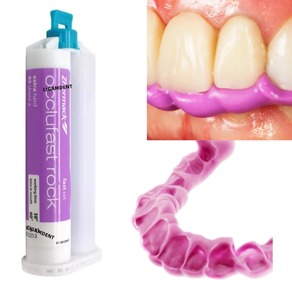 Dental Bite Registration Impression Material Silicone Mixing Tube Dental Impression record Mixing Tips
Dental Bite Registration Impression Material Silicone Mixing Tube Dental Impression record Mixing Tips