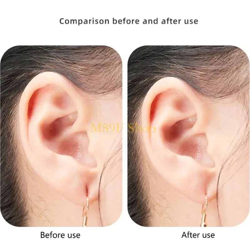 M89F Invisible Adhesive Backings For Droopy Ears Friendly Support Patches Stickers
M89F Invisible Adhesive Backings For Droopy Ears Friendly Support Patches Stickers