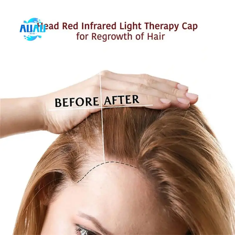 AUAU-Infrared Hair Growth Instrument Physiotherapy Head Cap Laser Red Blue Light Hair Care Device Relaxation Therapy
AUAU-Infrared Hair Growth Instrument Physiotherapy Head Cap Laser Red Blue Light Hair Care Device Relaxation Therapy