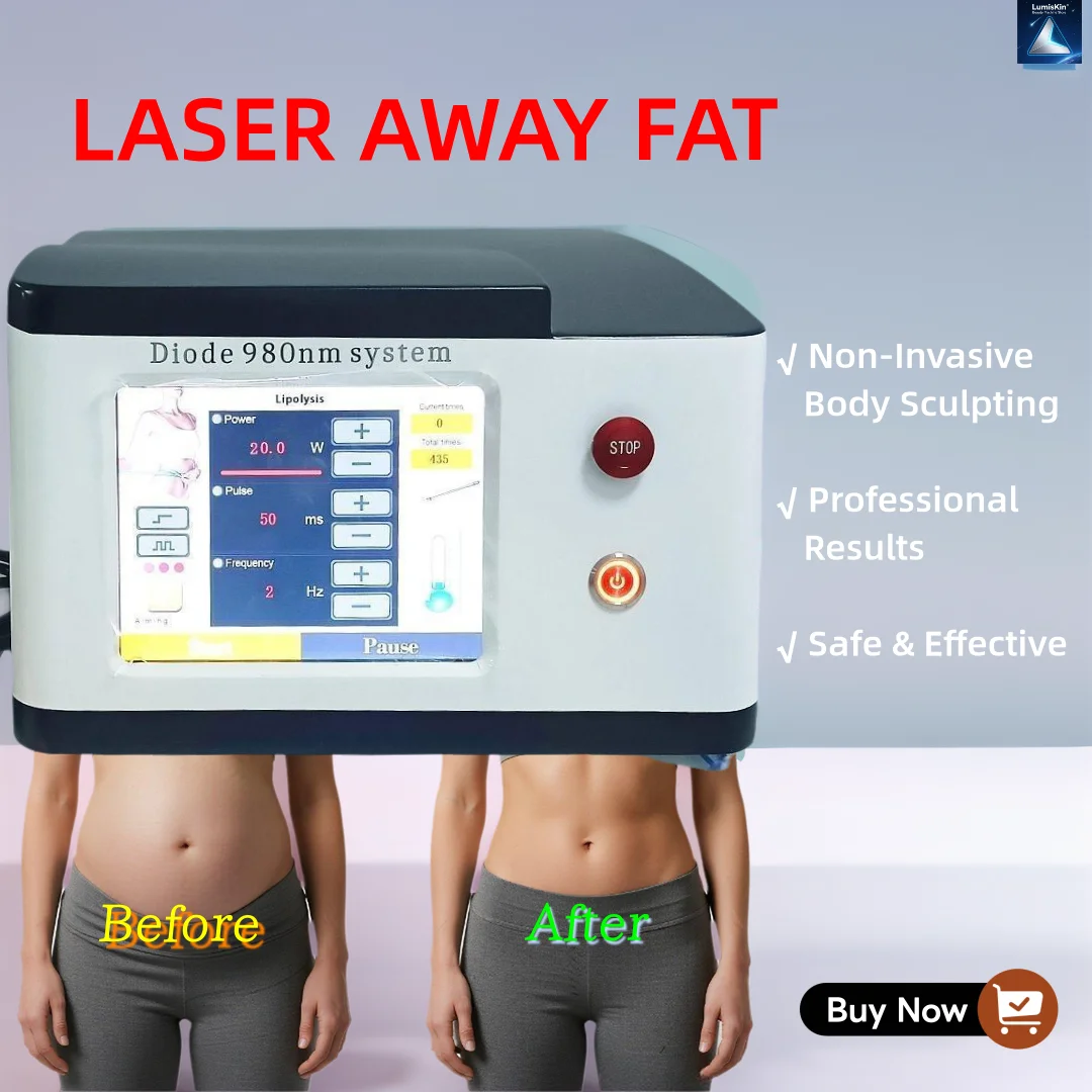 Лазерное устройство для моделирования тела с двойной длиной волны: нехирургическое уменьшение жира и подтяжка кожи. Использование медицинской вакуумной аспирационной системы.
Лазерное устройство для моделирования тела с двойной длиной волны: нехирургическое уменьшение жира и подтяжка кожи. Использование медицинской вакуумной аспирационной системы.