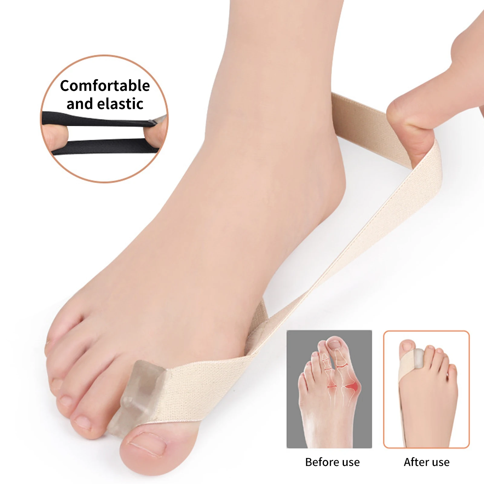 Hallux Valgus Corrector One Side Thumb Valgus Corrector Tension Strap Pain Relief Toefinger Separator Toe Straightener Tool
Hallux Valgus Corrector One Side Thumb Valgus Corrector Tension Strap Pain Relief Toefinger Separator Toe Straightener Tool