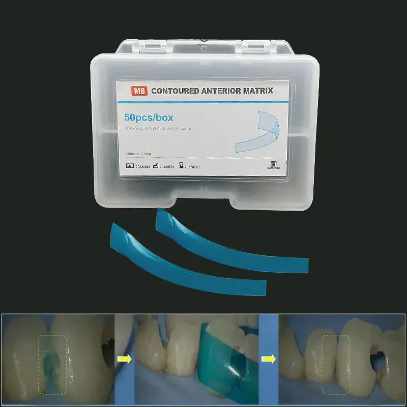 50pcs/Set Dental Contoured Anterior Matrix Blue Transparent Anterior Polyester Strip Thickness 0.05mm Dental Materials
50pcs/Set Dental Contoured Anterior Matrix Blue Transparent Anterior Polyester Strip Thickness 0.05mm Dental Materials