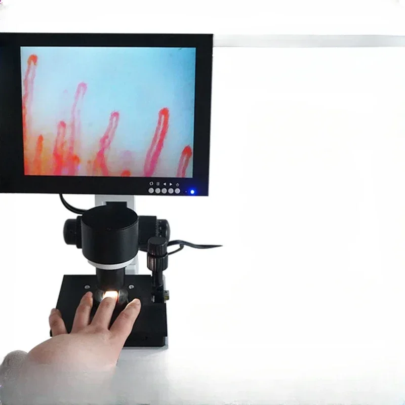 Xw3000 miniature circulation observation instrument color portable integrated observation instrument microscope
Xw3000 miniature circulation observation instrument color portable integrated observation instrument microscope