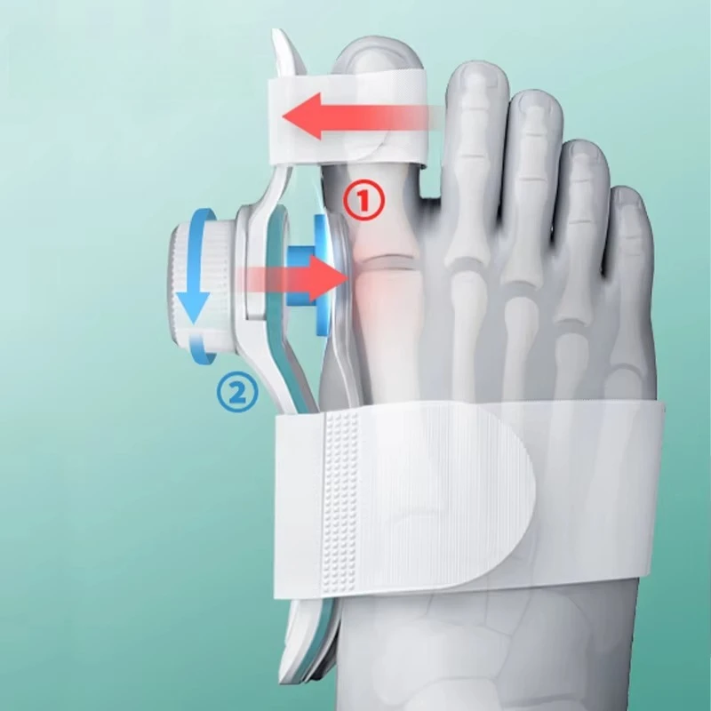 Orthopedic Relief Bunion Splint 3 Different Angle Fixing Plate Big Toe Straightener Bunion Corrector for Women & Men
Orthopedic Relief Bunion Splint 3 Different Angle Fixing Plate Big Toe Straightener Bunion Corrector for Women & Men