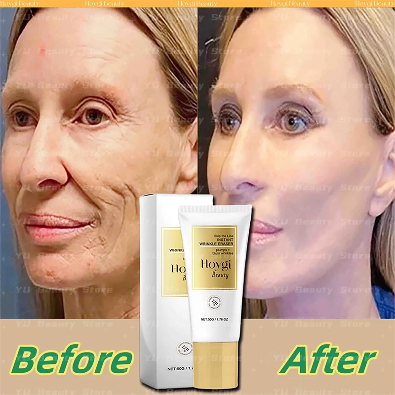 Retinol Anti-Wrinkle Face Cream Hyaluronic Acid Anti-Aging Fade Fine Lines Moisturizing Lift Firming Korean Brighten Skin Care
Retinol Anti-Wrinkle Face Cream Hyaluronic Acid Anti-Aging Fade Fine Lines Moisturizing Lift Firming Korean Brighten Skin Care