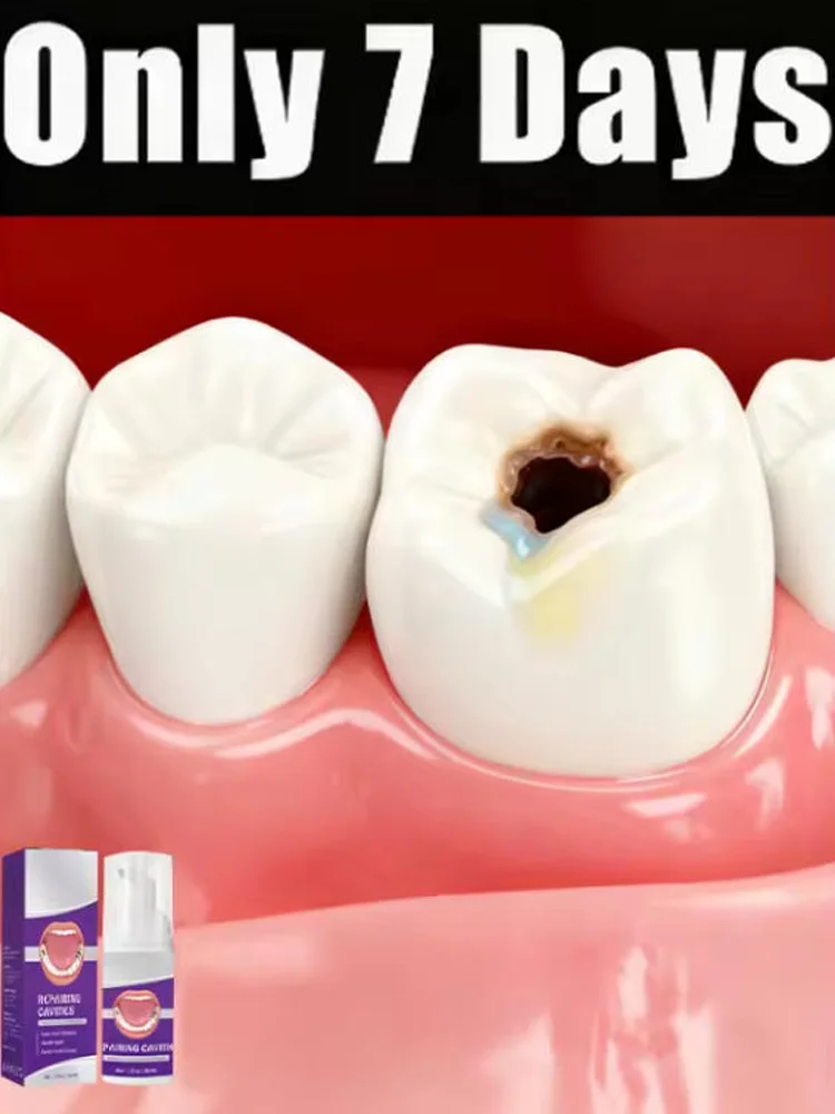 Oral repair patches, oral inlays, orthodontic patches, discolored and damaged oral care tools
Oral repair patches, oral inlays, orthodontic patches, discolored and damaged oral care tools