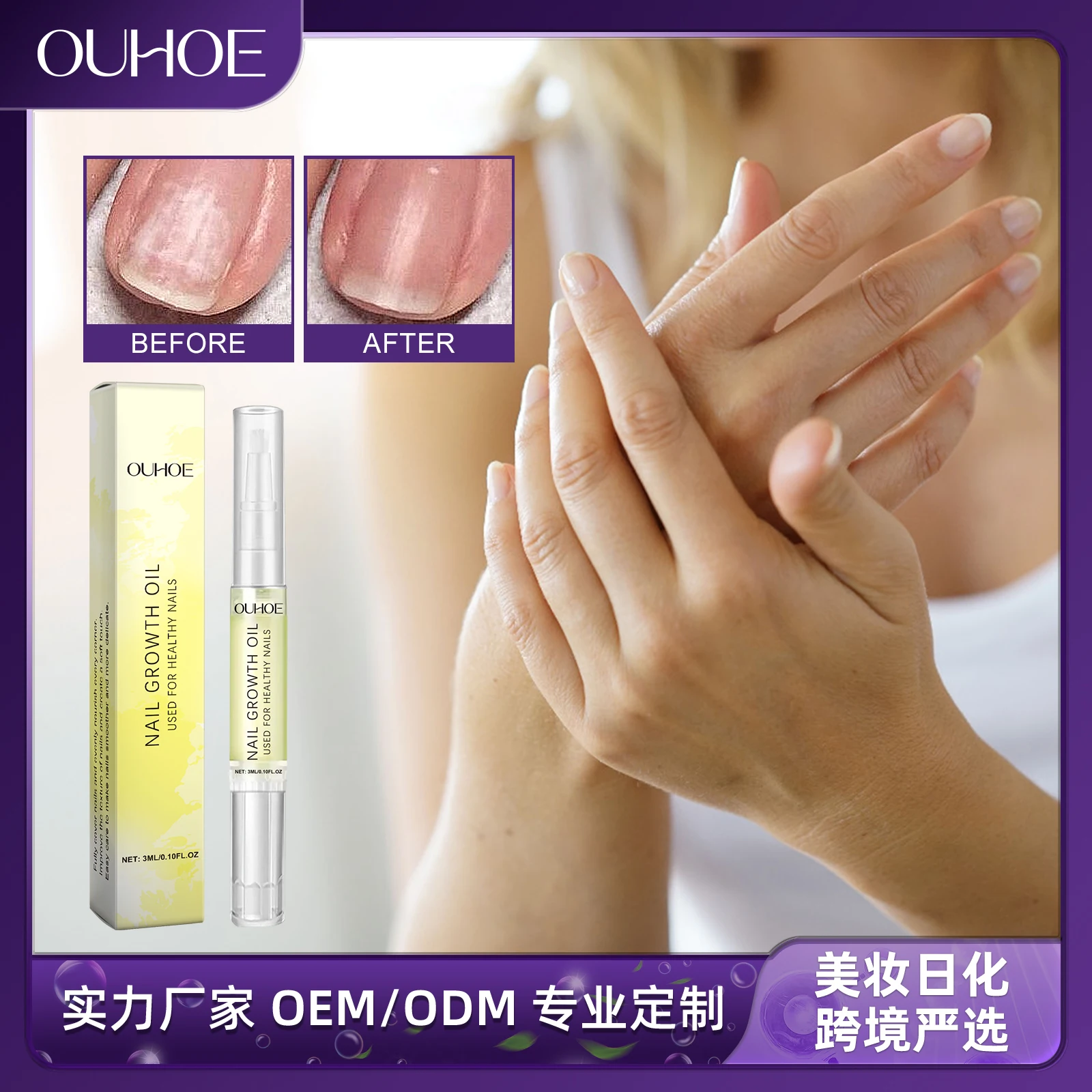Nail Care Oil Daily Soft Ingrown Nails Cleansing And Moisturizing Repair Solution
Nail Care Oil Daily Soft Ingrown Nails Cleansing And Moisturizing Repair Solution