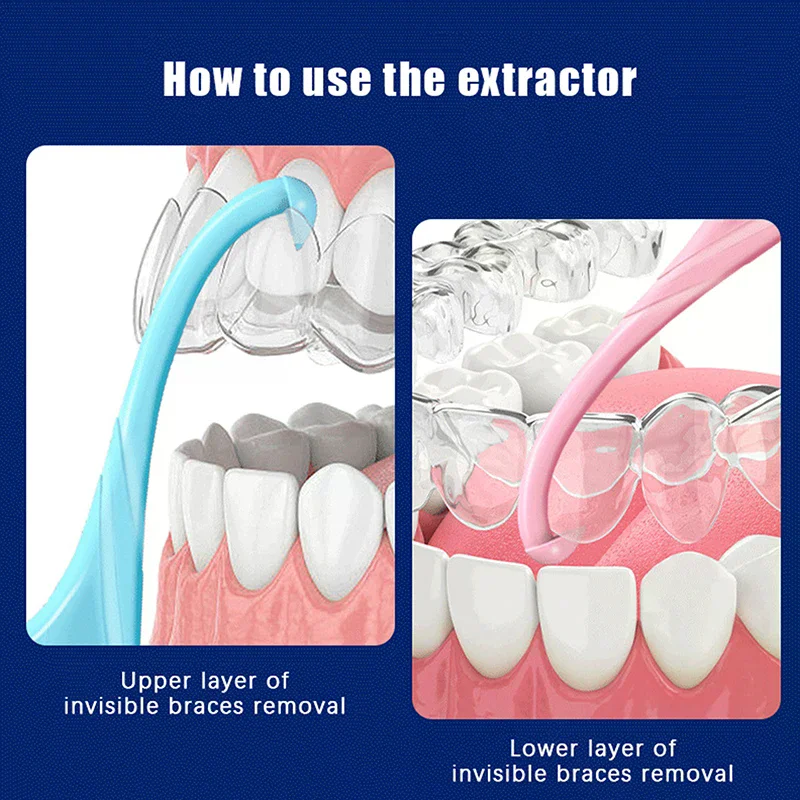 Набор из 4 аксессуаров: Силиконовые приспособления для снятия ортодонтических брекетов, элайнеров и элайнер-гриппер, инструмент для снятия зубных протезов и брекетов, силиконовый лоток
Набор из 4 аксессуаров: Силиконовые приспособления для снятия ортодонтических брекетов, элайнеров и элайнер-гриппер, инструмент для снятия зубных протезов и брекетов, силиконовый лоток