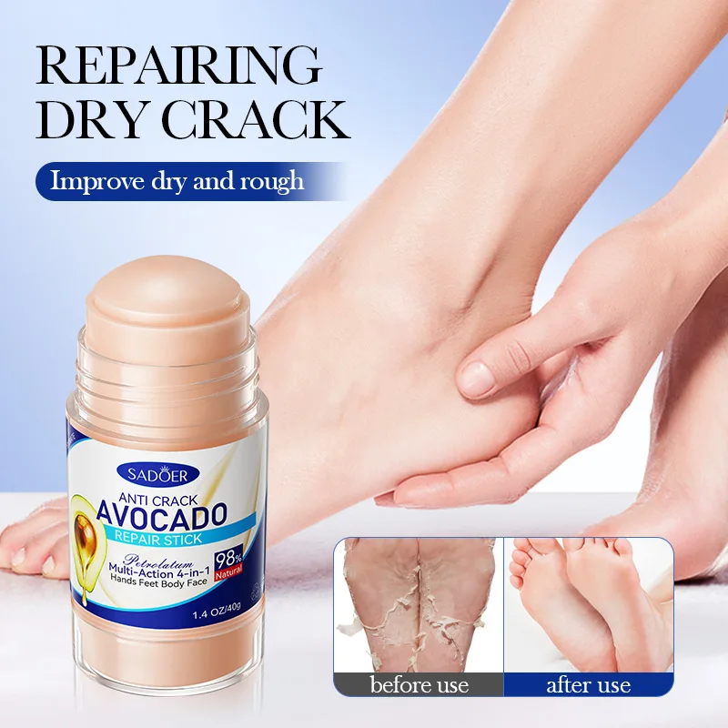 Крем для ног Squared Shark Vaseline Avocado, восстановление трещин на пятках, отшелушивание, удаление омертвевшей кожи, увлажнение, гладкость кожи
Крем для ног Squared Shark Vaseline Avocado, восстановление трещин на пятках, отшелушивание, удаление омертвевшей кожи, увлажнение, гладкость кожи
