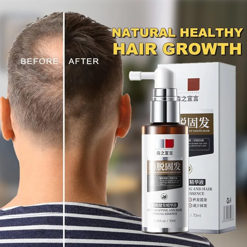 Fuller Hair Growth Serum Spray Natural Anti-Hair Loss Treatment for Thinning Promotes Thicker Essence for Women Men All Types
Fuller Hair Growth Serum Spray Natural Anti-Hair Loss Treatment for Thinning Promotes Thicker Essence for Women Men All Types